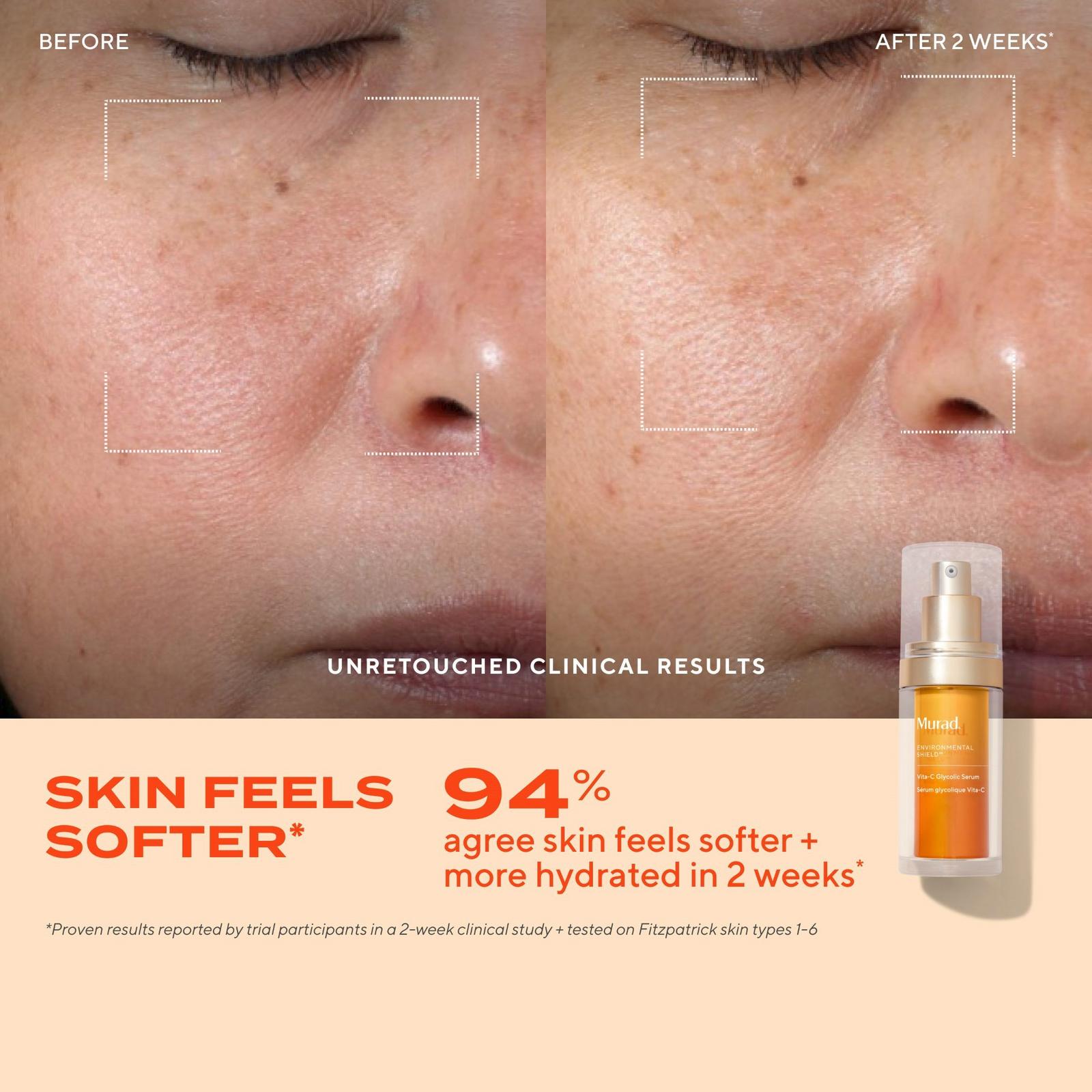 Vitamin C Glycolic Brightening Serum