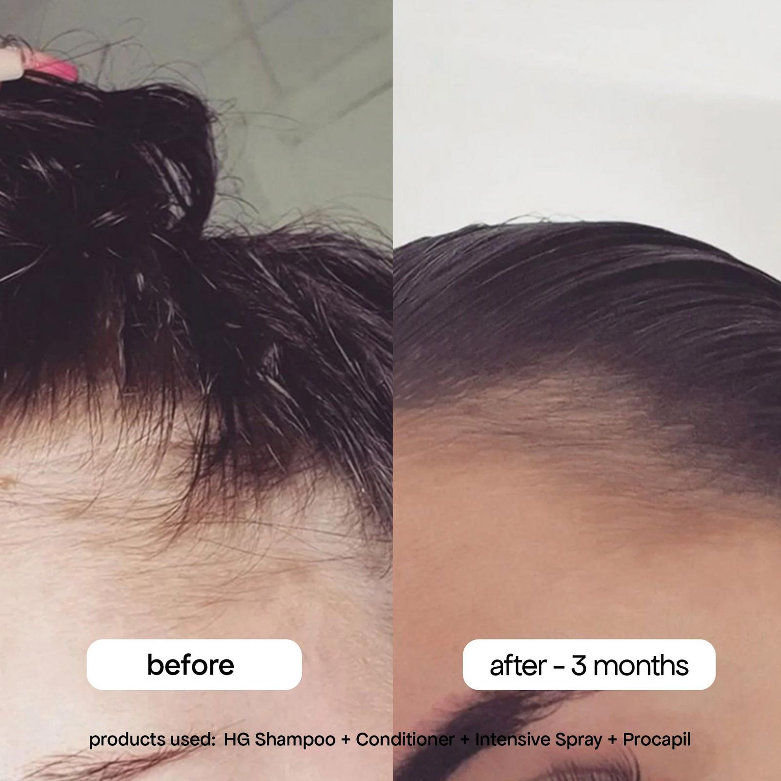 Intensive Daily Scalp Spray