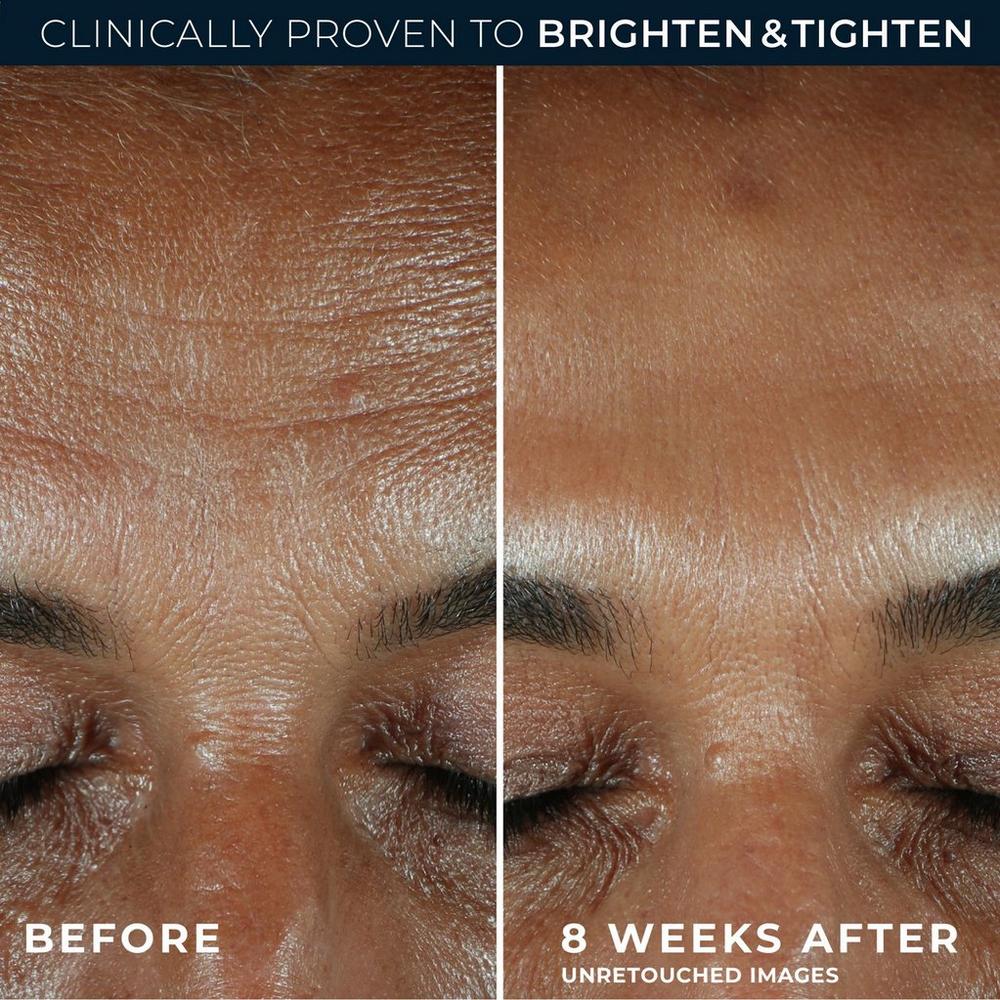 Vitamin C Brightening Serum for Dark Spots & Uneven Tone