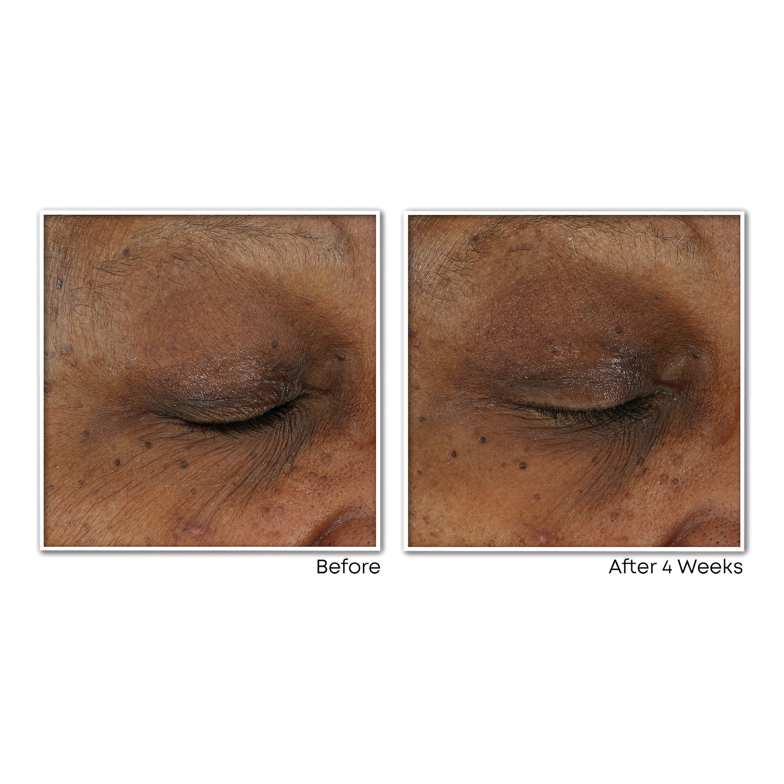 Vitamin C Brightening Serum for Dark Spots & Uneven Tone