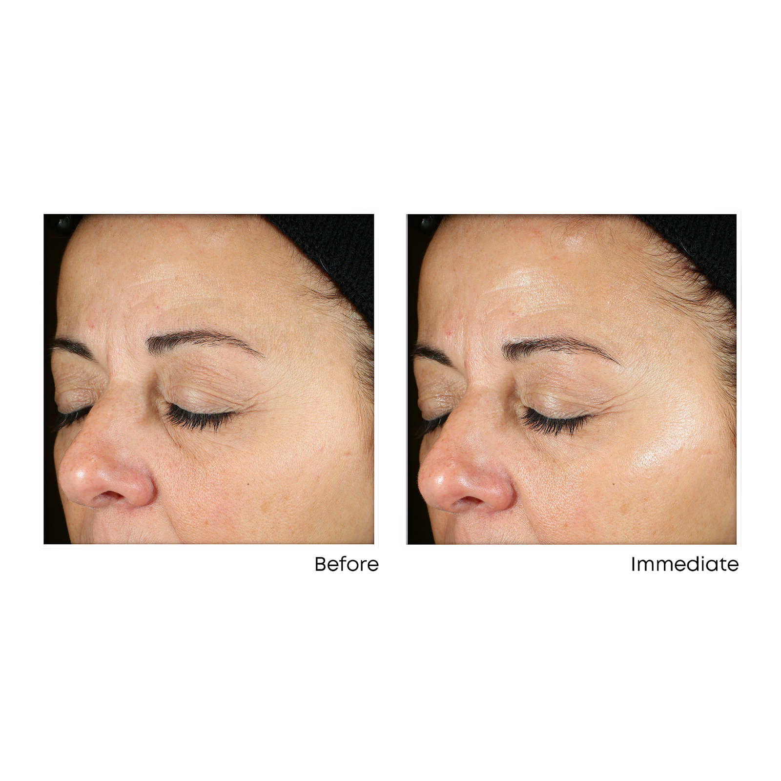 Vitamin C Brightening Serum for Dark Spots & Uneven Tone