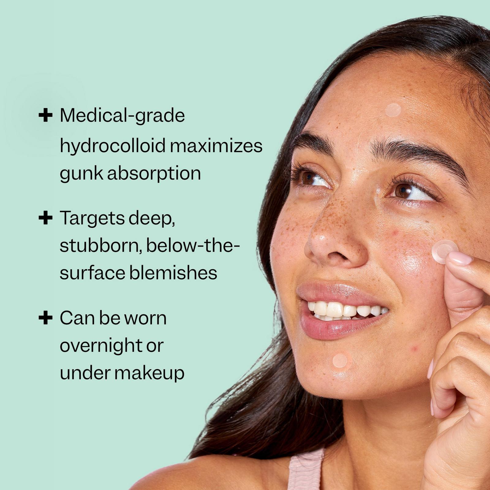 Deep Blemish Microdarts