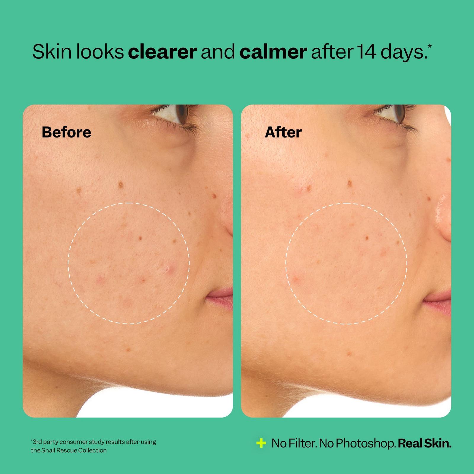 Snail Rescue Intensive Wash-Off Jelly Mask