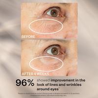 StriVectin - Peptight 360 Tightening Eye Serum | Ulta Beauty