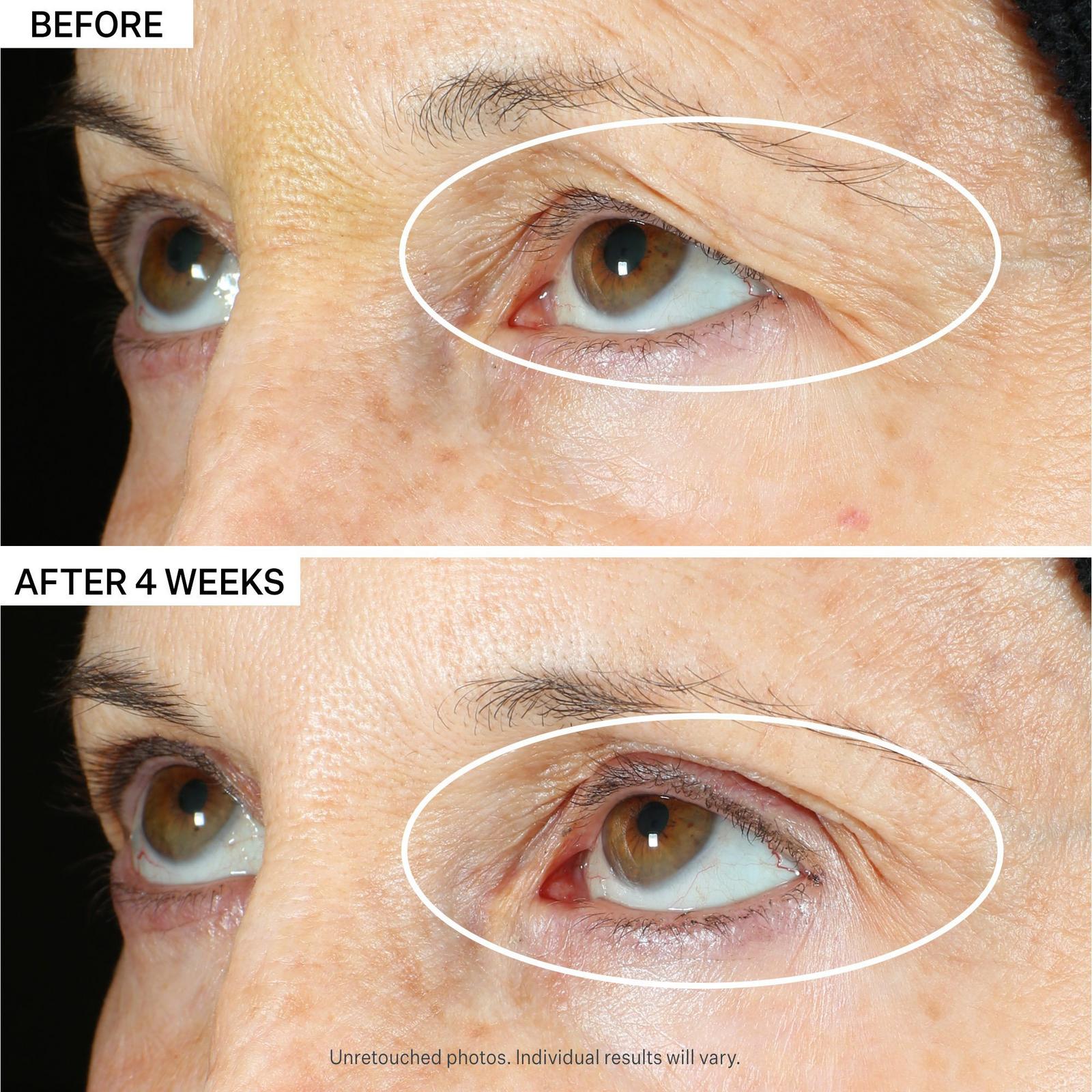 StriVectin - Peptight 360 Tightening Eye Serum | Ulta Beauty