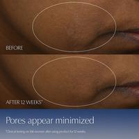 Estée Lauder Advanced Night Repair Multi-Recovery Complex Serum with Hyaluronic Acid & Peptides #6