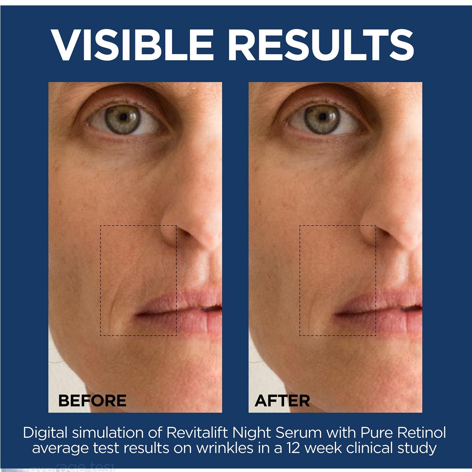 Revitalift Derm Intensives Night Serum with 0.3% Pure Retinol