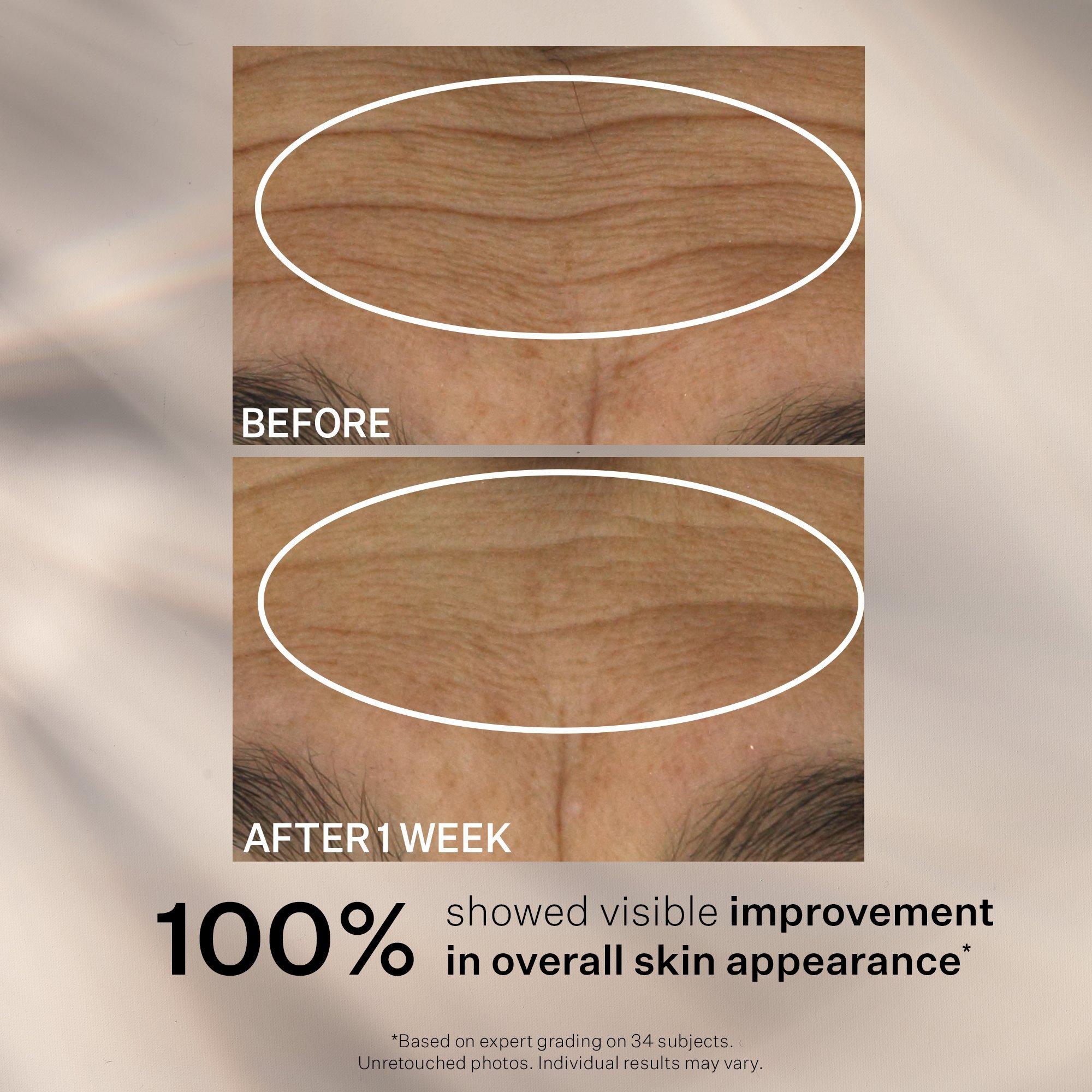 Увлажняющий защитный крем StriVectin Wrinkle Recode — фото 6