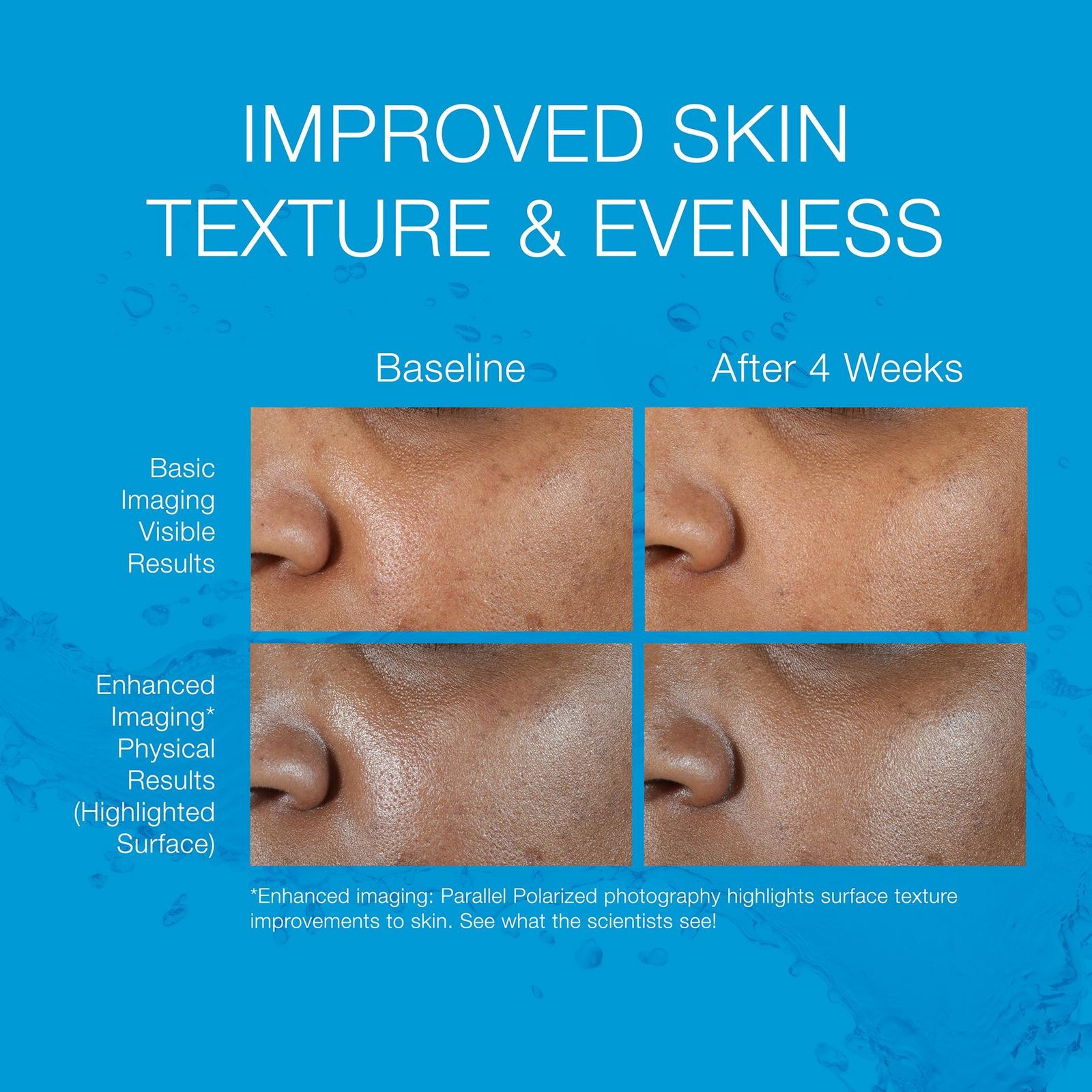 Hydro Boost Hyaluronic Acid Serum