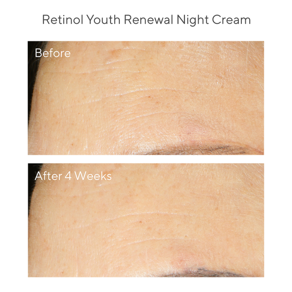 Murad Youth Renewal Retinol Trial Kit #3