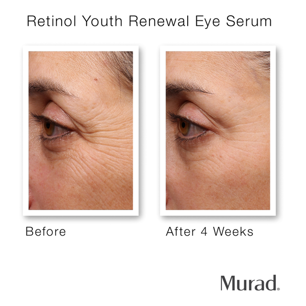 Murad Youth Renewal Retinol Trial Kit #4