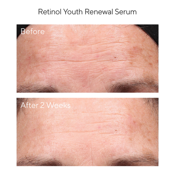 Murad Youth Renewal Retinol Trial Kit #5