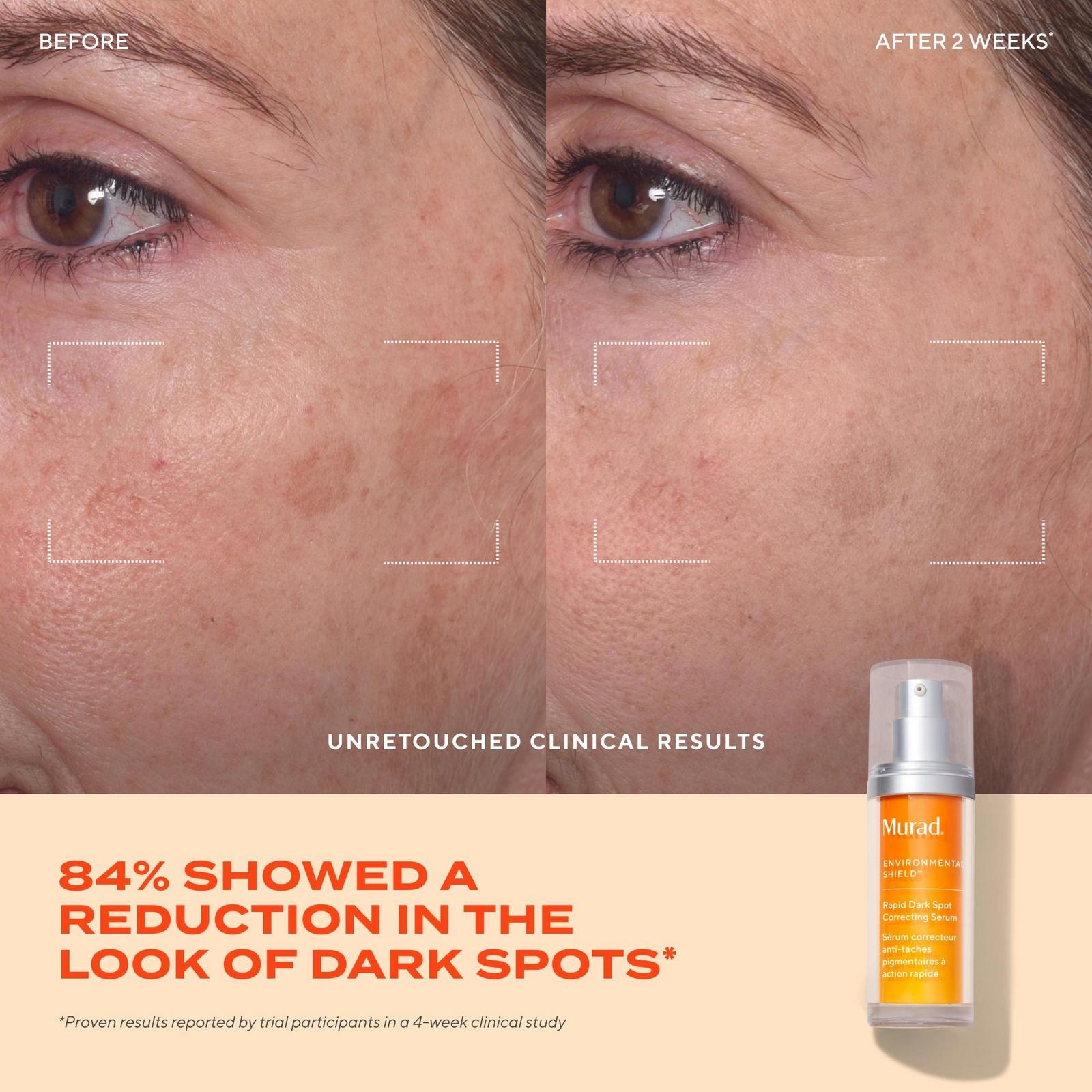 Rapid Dark Spot Correcting Serum