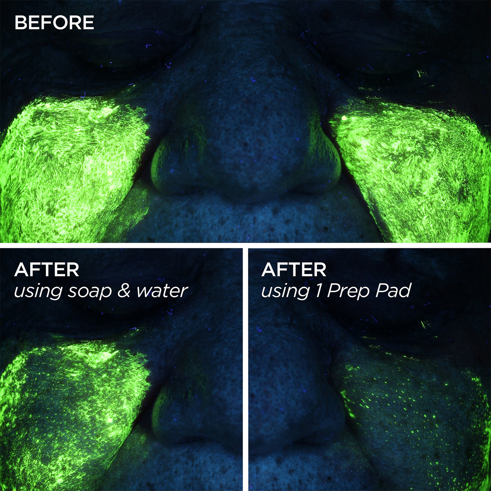GloPRO Skin Prep Pads Clarifying Skin Cleansing Wipes with Peptides