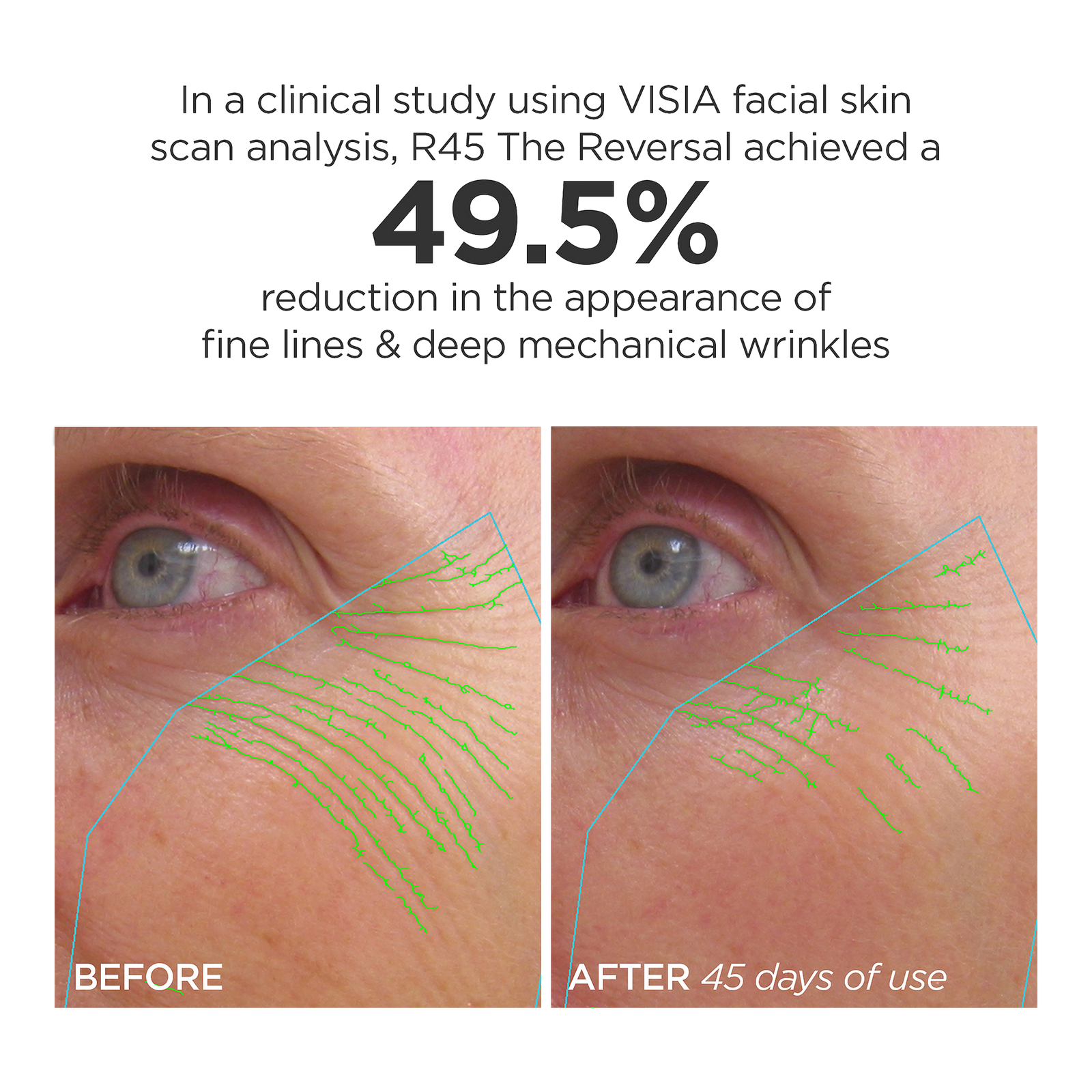 R45 The Reversal 3-Phase Retinol Booster System