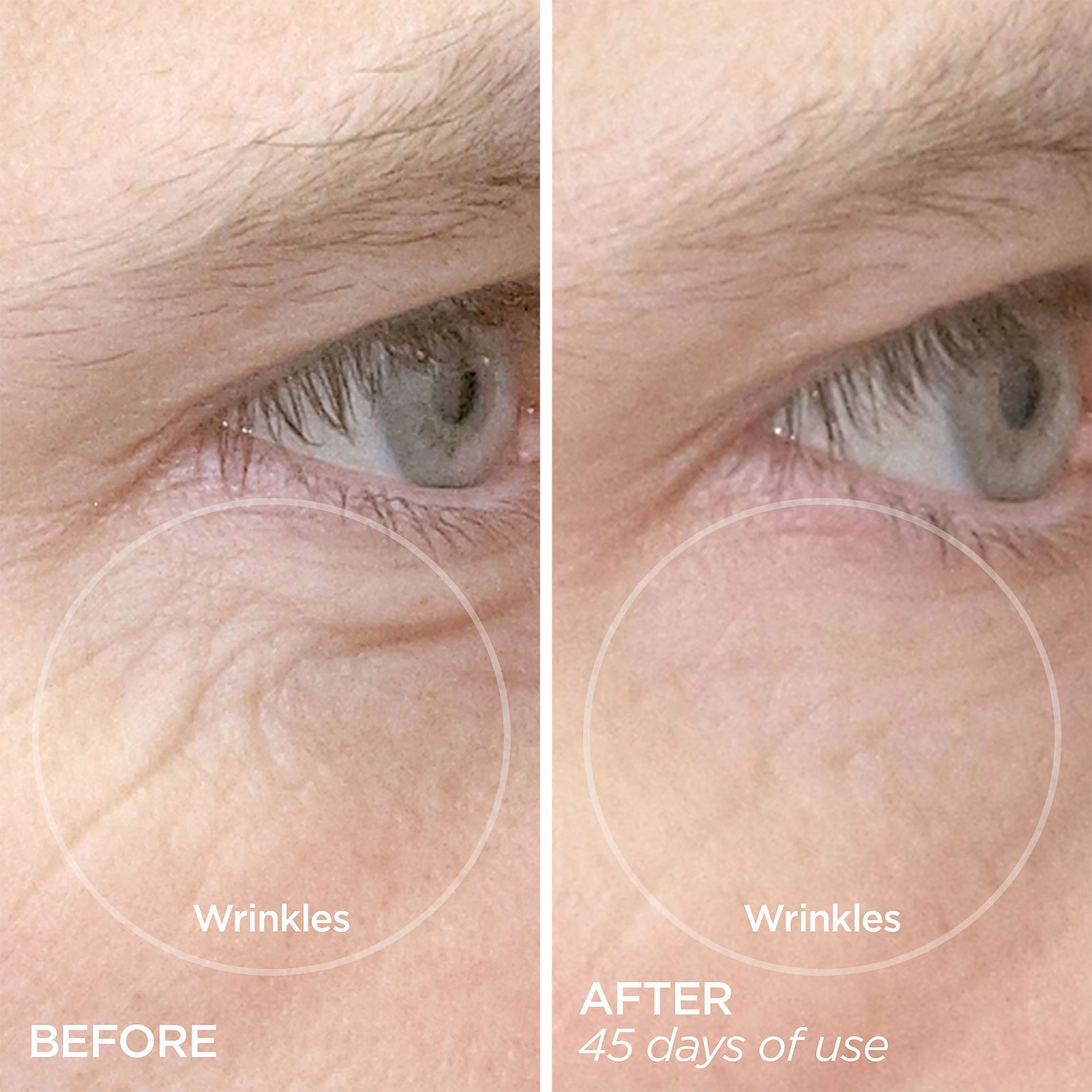 R45 The Reversal 3-Phase Retinol Booster System