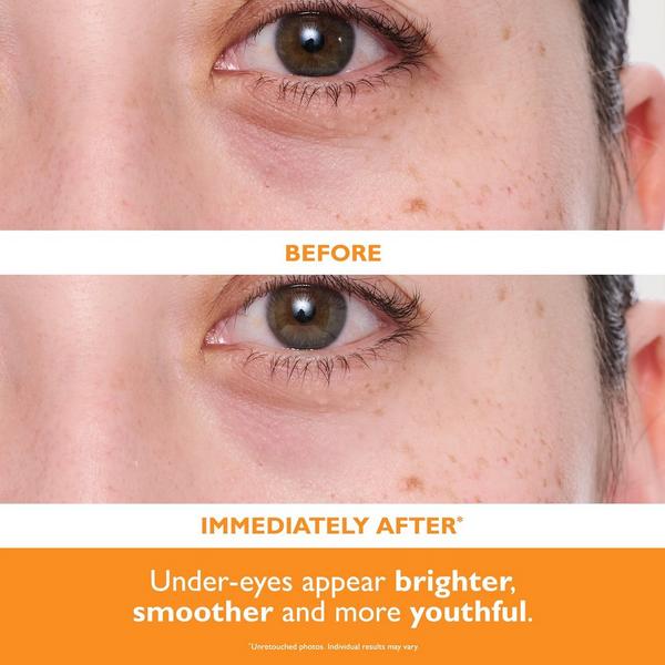 Peter Thomas Roth Potent-C Power Brightening Hydra-Gel Eye Patches #2