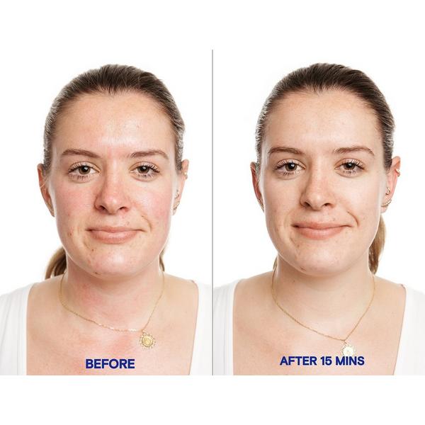 KORRES Greek Yoghurt Probiotic Superdose Face Mask #7