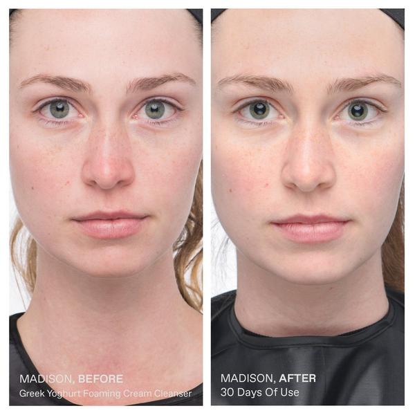 KORRES Greek Yoghurt Foaming Cream Cleanser #6