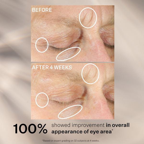 StriVectin Intensive Eye Concentrate For Wrinkles PLUS #6