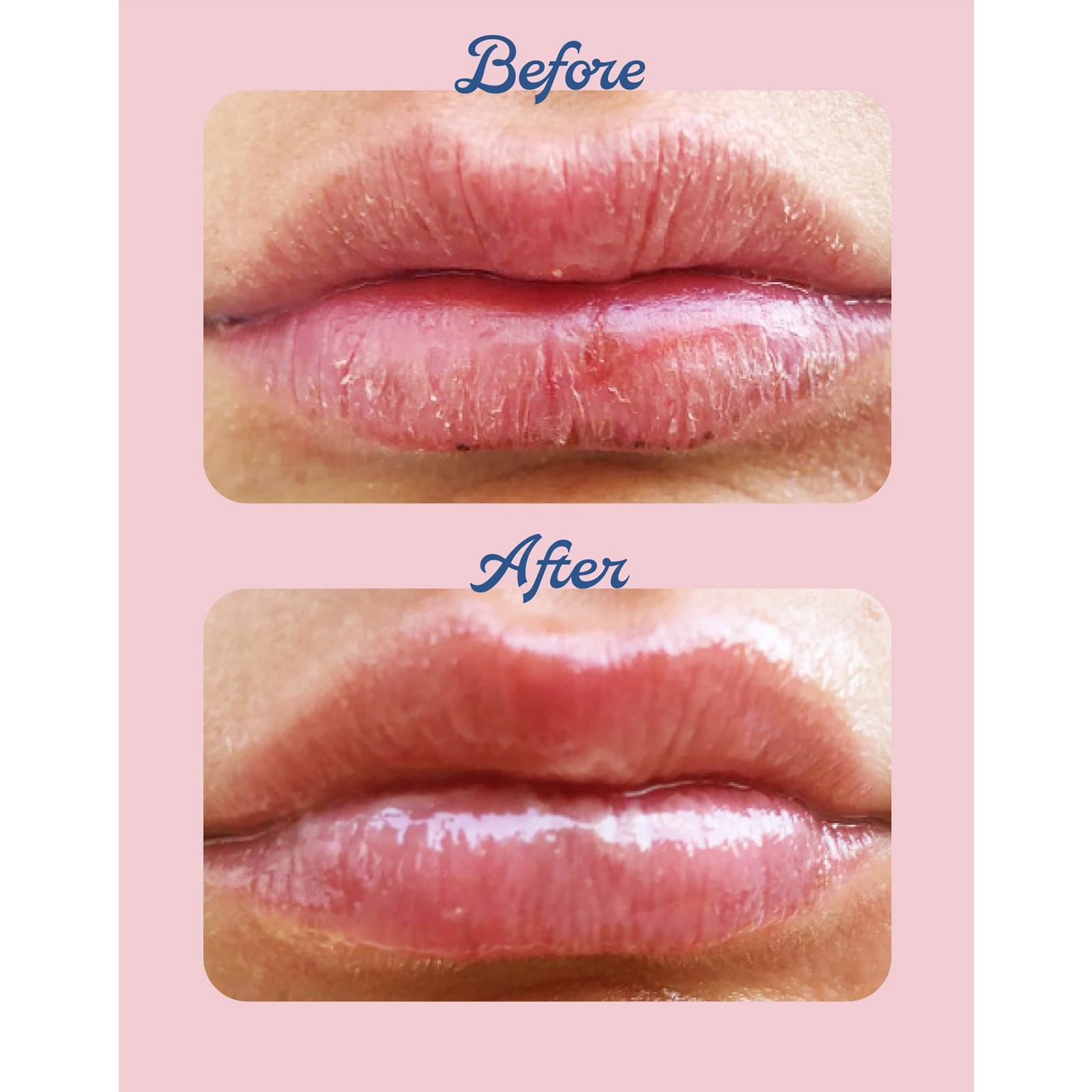 Green Apple 101 Ointment Multi-Balm