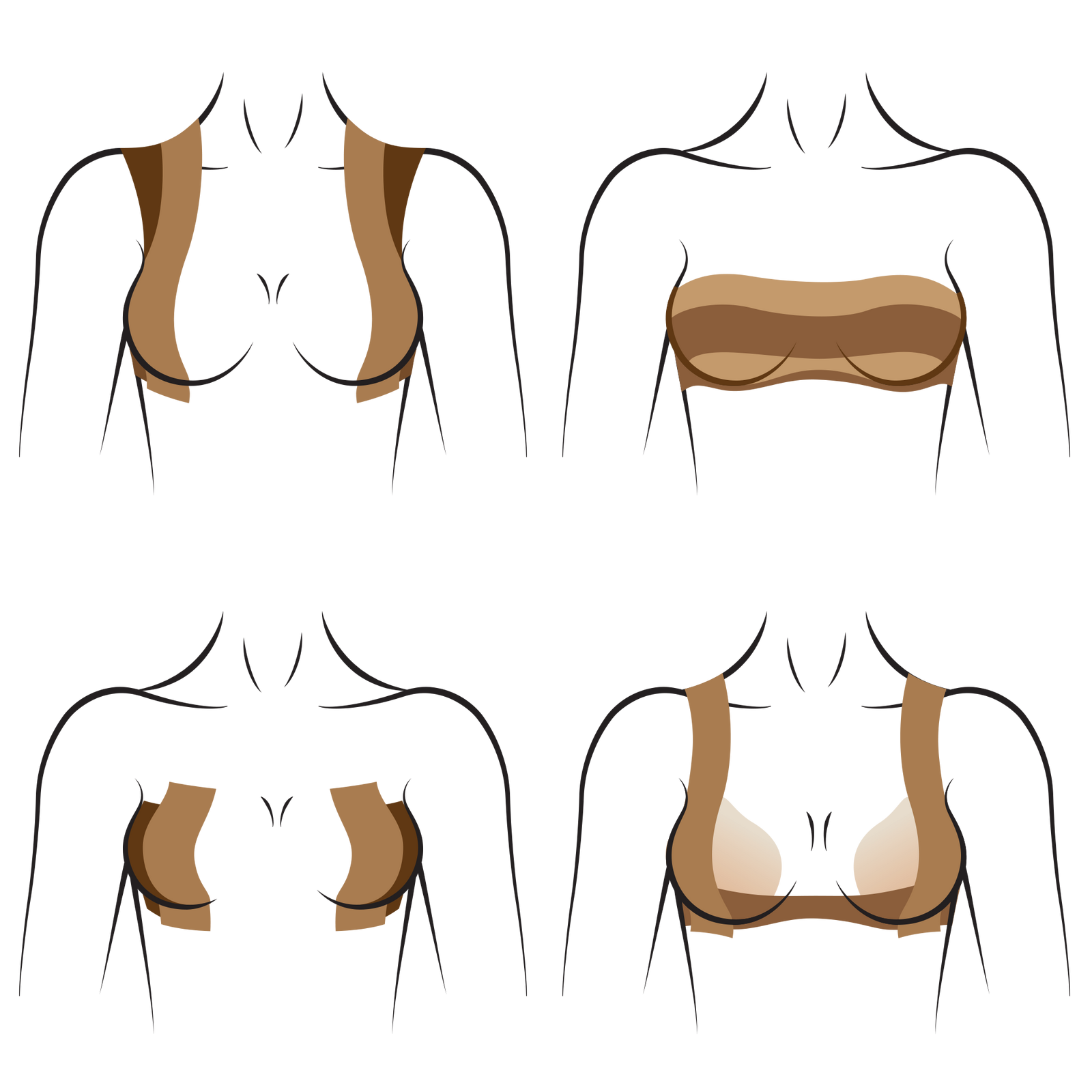 Breast Contour Tape, Self-Adhesive Disposables