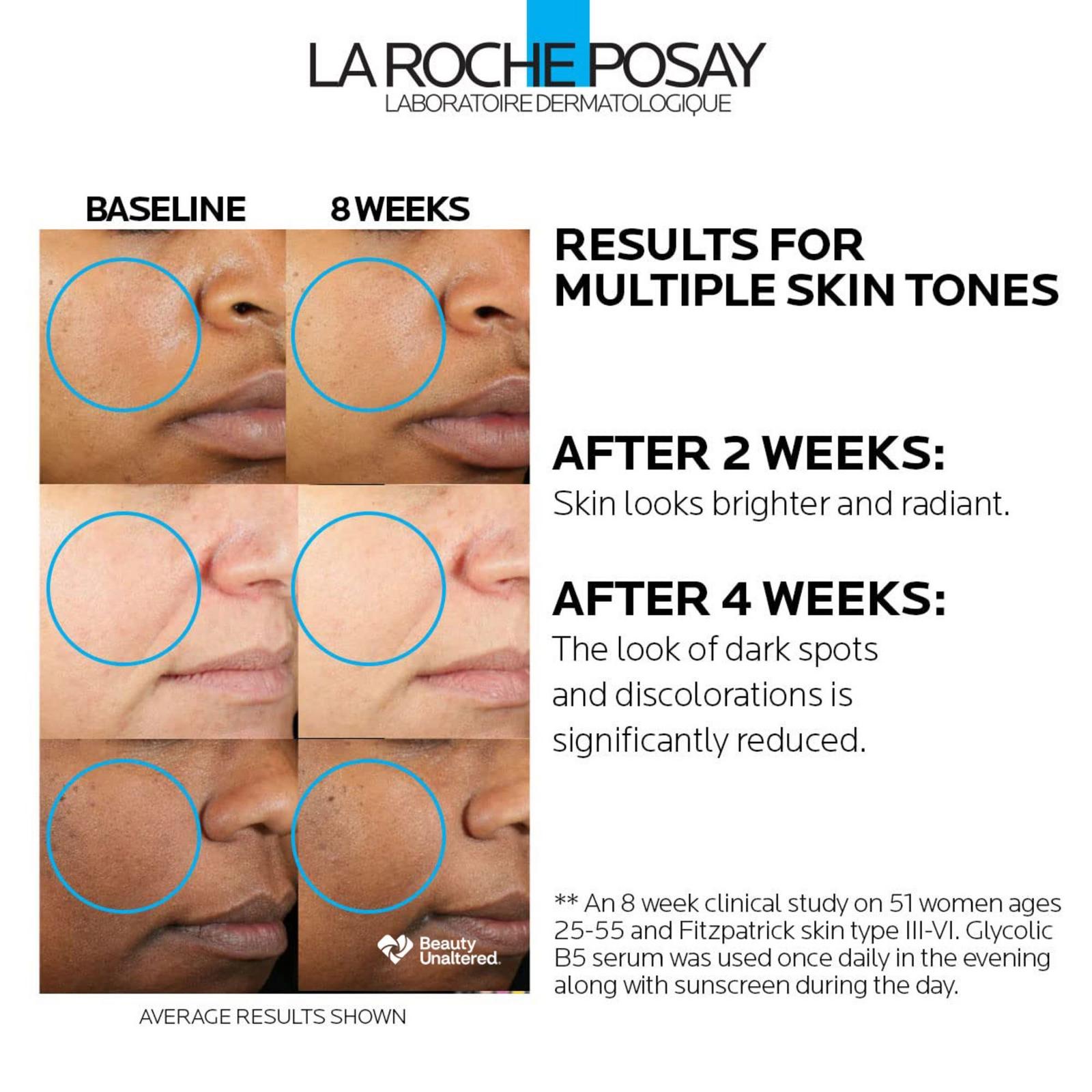 Glycolic B5 Dark Spot Corrector