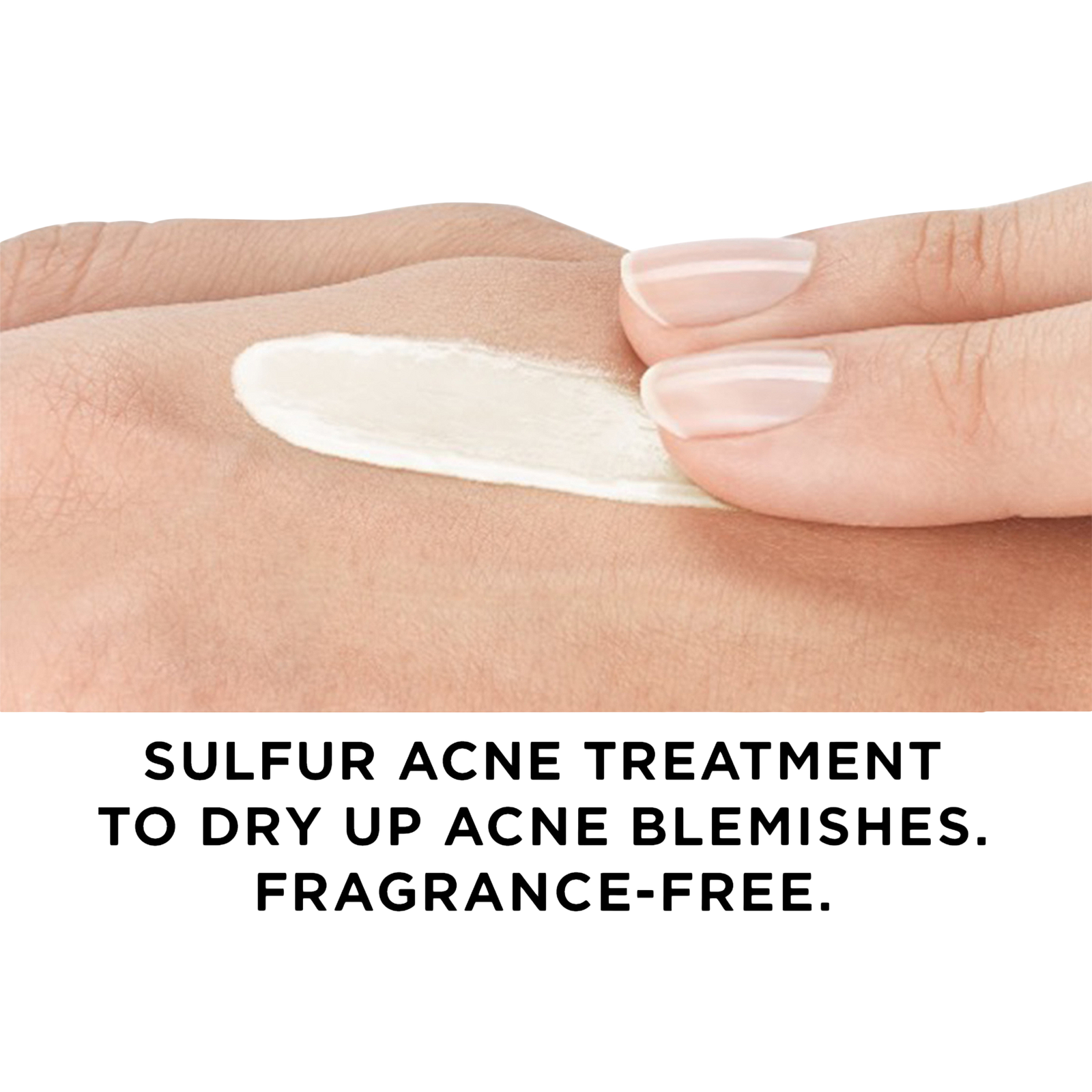 Normaderm S.O.S Acne Rescue Spot Corrector