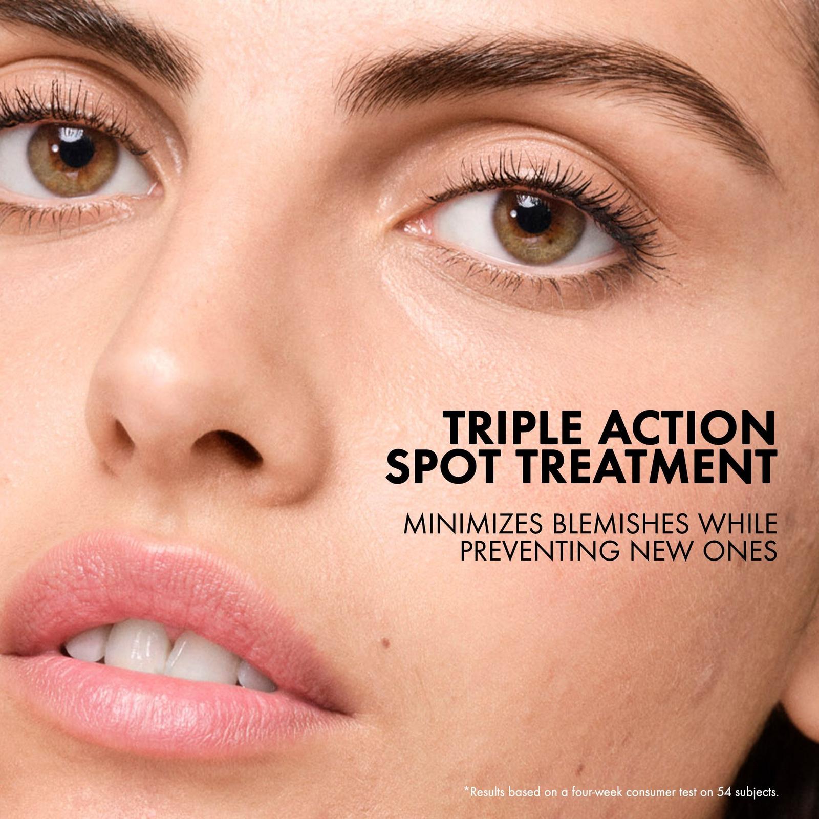 Normaderm S.O.S Acne Rescue Spot Corrector