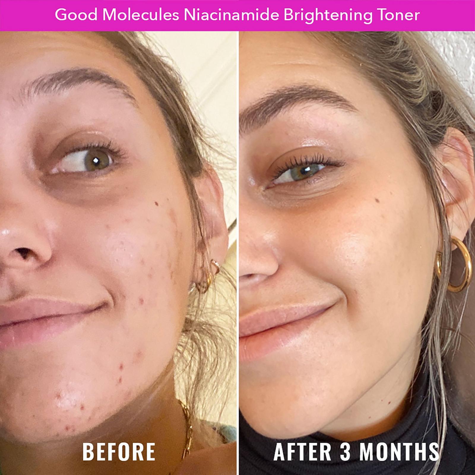 Niacinamide Brightening Toner