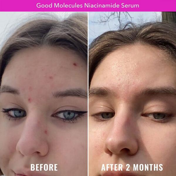 Good Molecules Niacinamide Serum #4