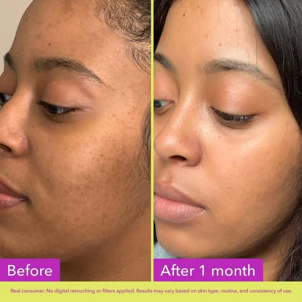 Good Molecules Glycolic Exfoliating Toner #3
