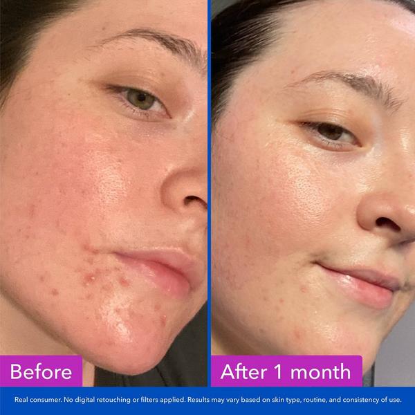 Good Molecules Clarify & Cleanse Bar #3
