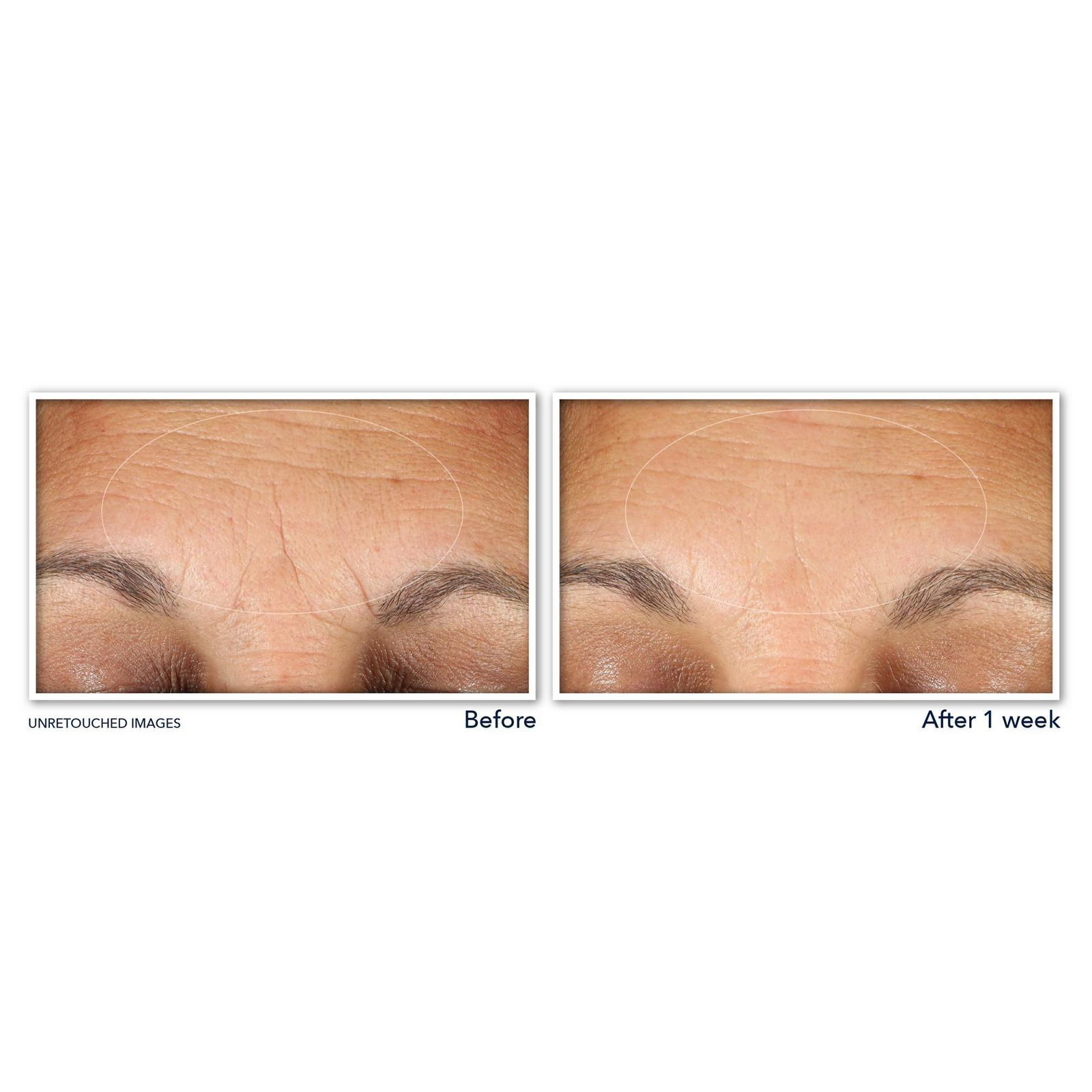 Multi Correxion Hydrate + Plump Hyaluronic Acid Eye Cream