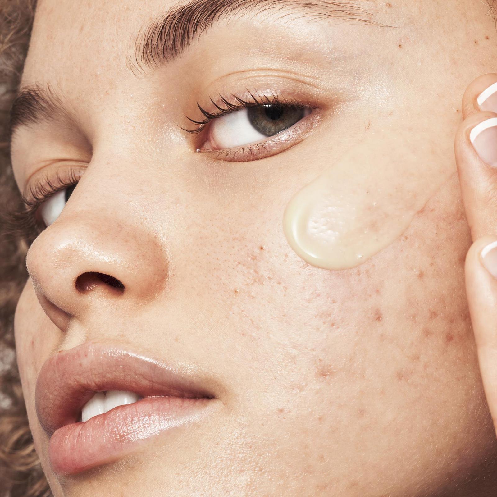 Acne Fighting Putty Primer