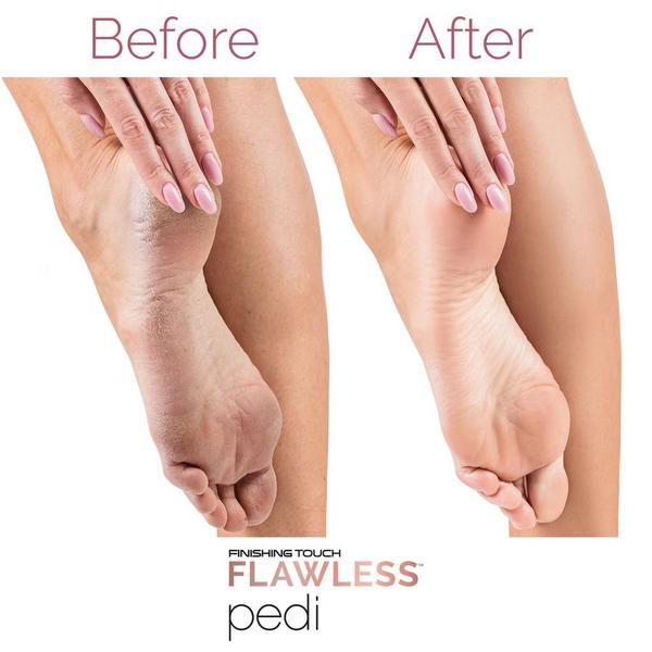 Flawless by Finishing Touch Flawless Pedi Electronic Tool File and Callus Remover #7