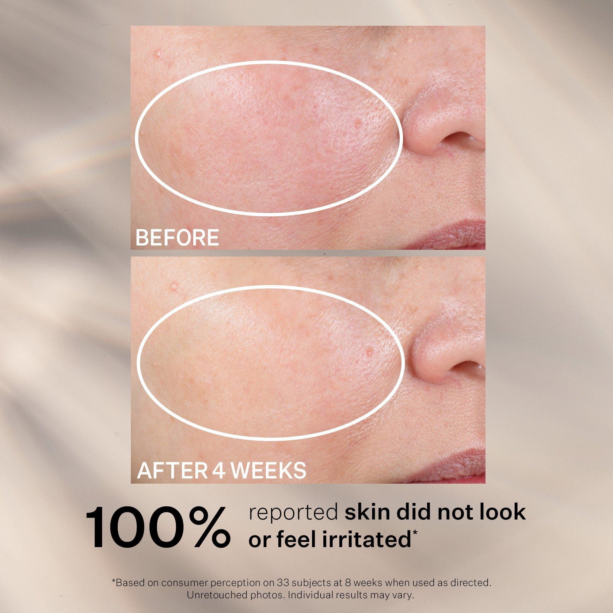 Ночной обновляющий увлажняющий крем StriVectin Advanced Retinol — фото 6