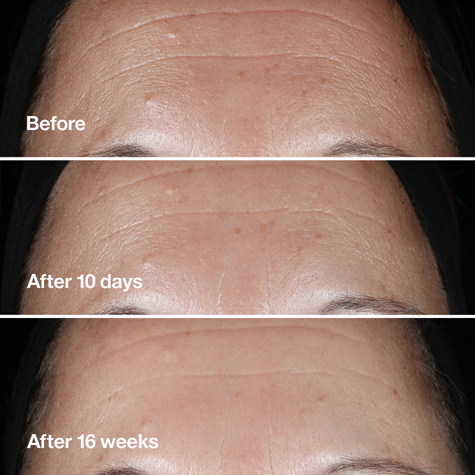 Clinique Smart Clinical Repair Wrinkle Correcting Serum