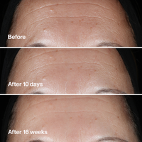 Clinique Clinique Smart Clinical Repair Wrinkle Correcting Serum #3