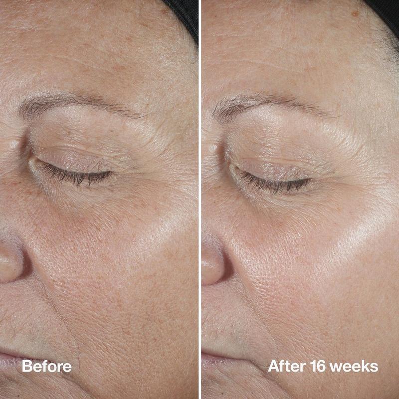 Clinique - 3.4 oz Clinique Smart Clinical Repair Wrinkle