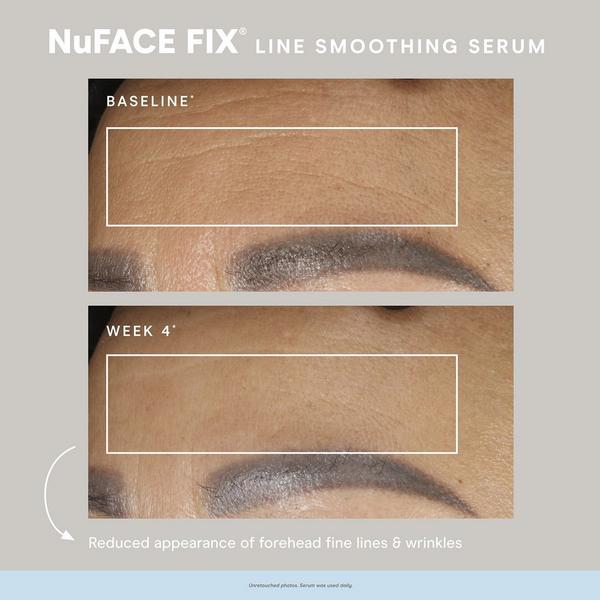 NuFACE Line Smoothing FIX Serum with Triple Peptide Complex #4