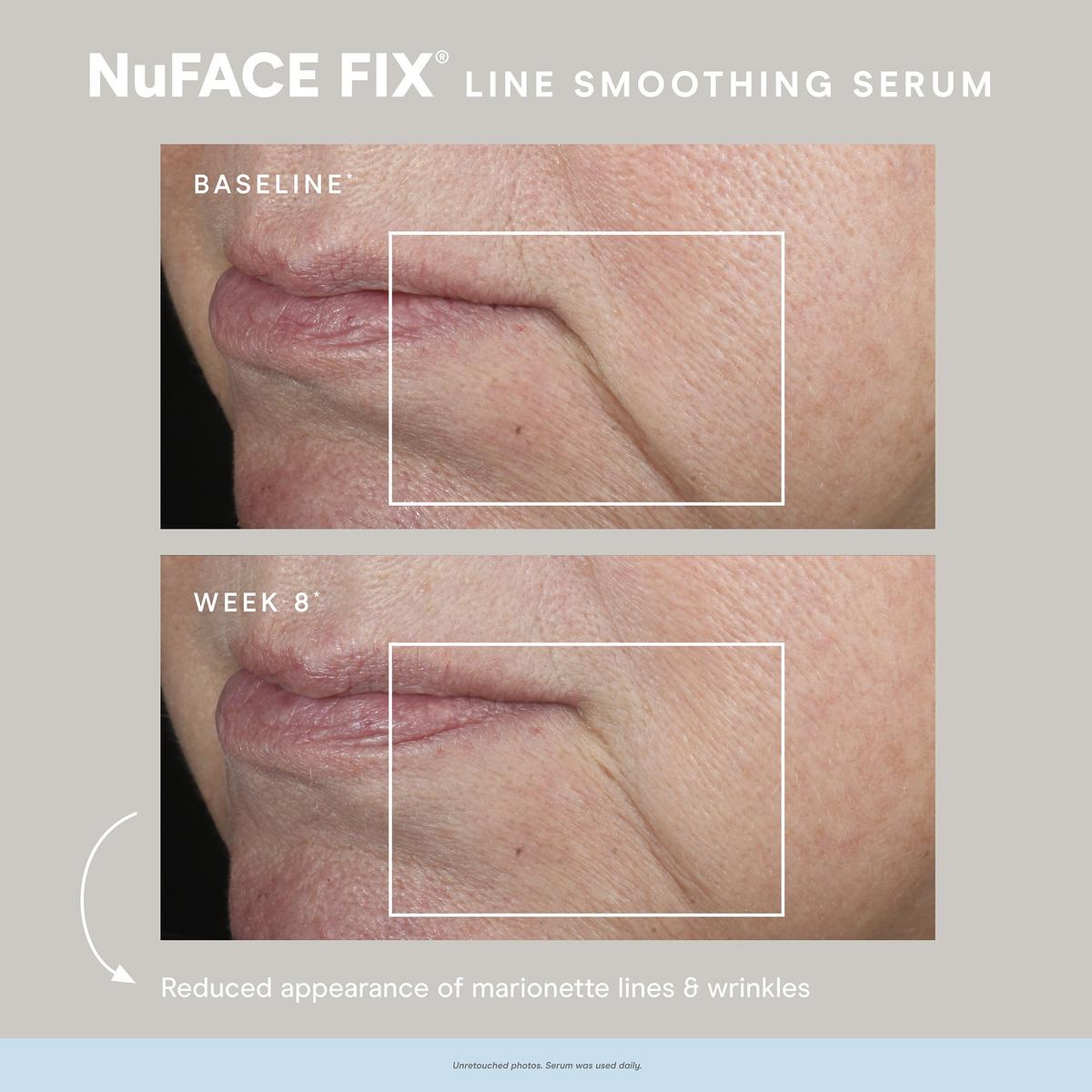 Nuface Mini with Nuface Fix line smoothing serum newest