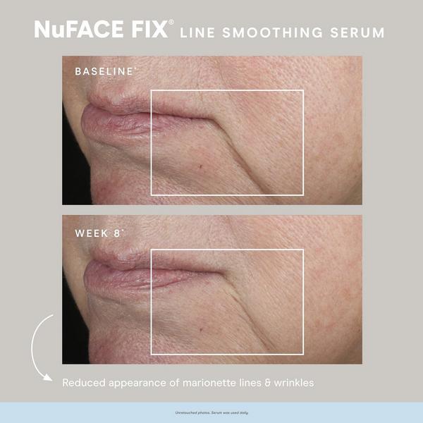 NuFACE Line Smoothing FIX Serum with Triple Peptide Complex #5