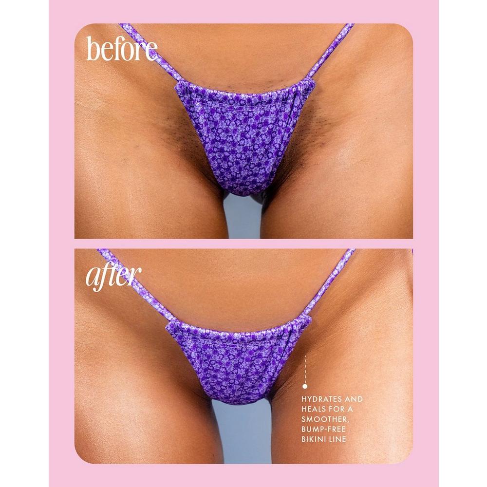 Cooka Concentrate Ingrown Serum