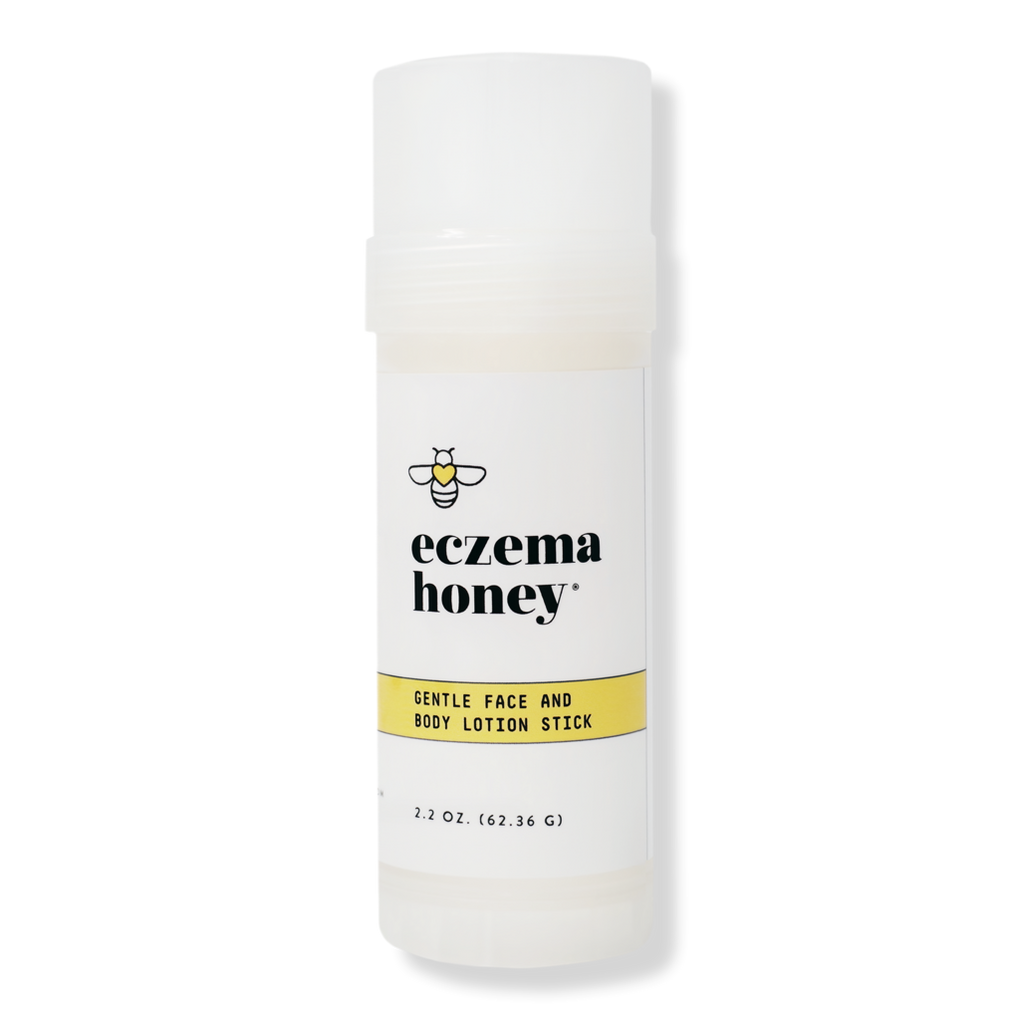 Eczema Honey Scalp Oil Treatment