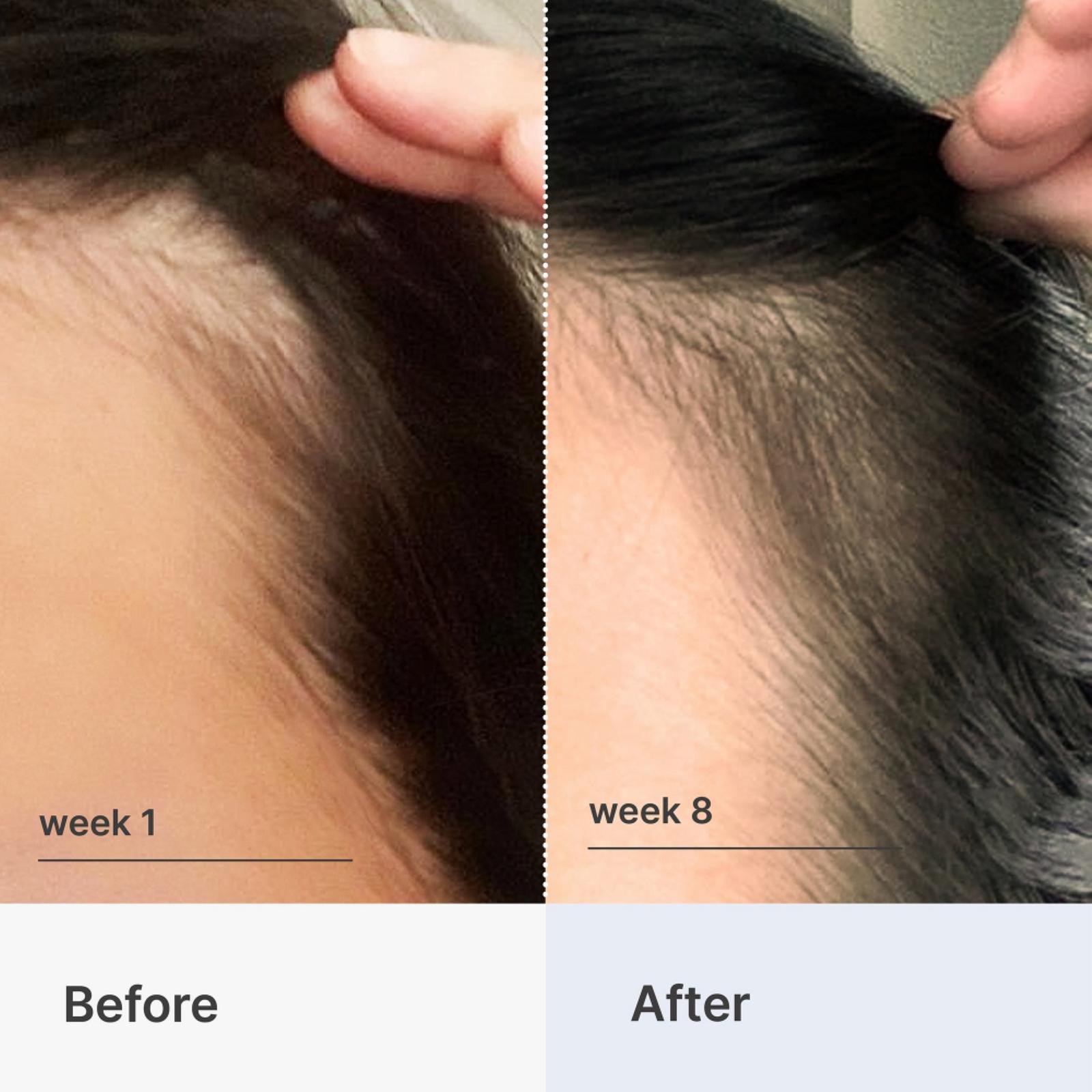 Superpower Fortifying Hair & Scalp Serum