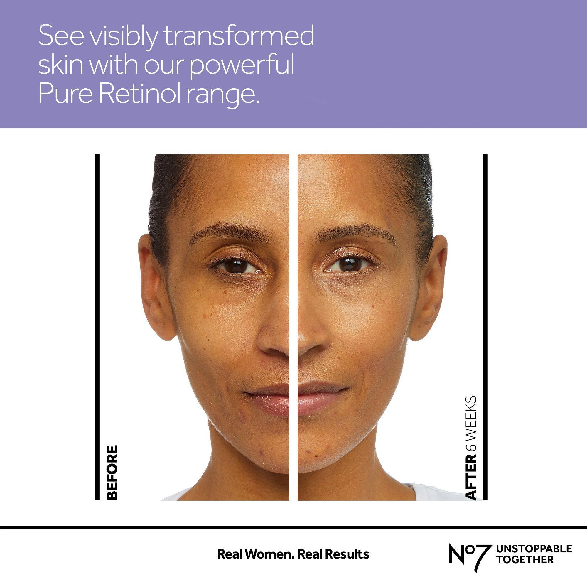 Крем для кожи вокруг глаз с ретинолом без отдушки No7 Pure Retinol — фото 6