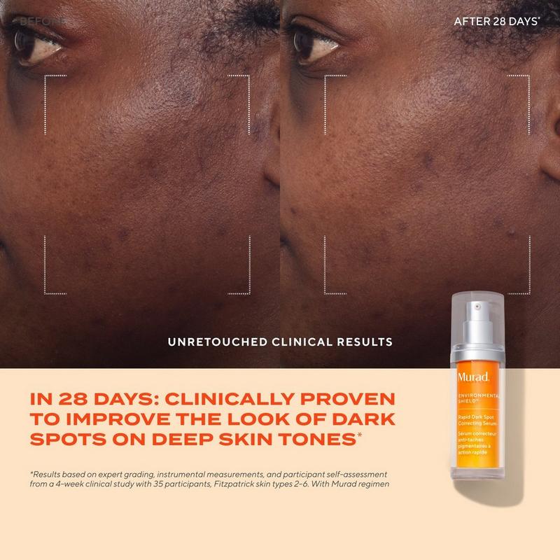 Murad - 0.3 oz Rapid Dark Spot Correcting Serum | Ulta Beauty