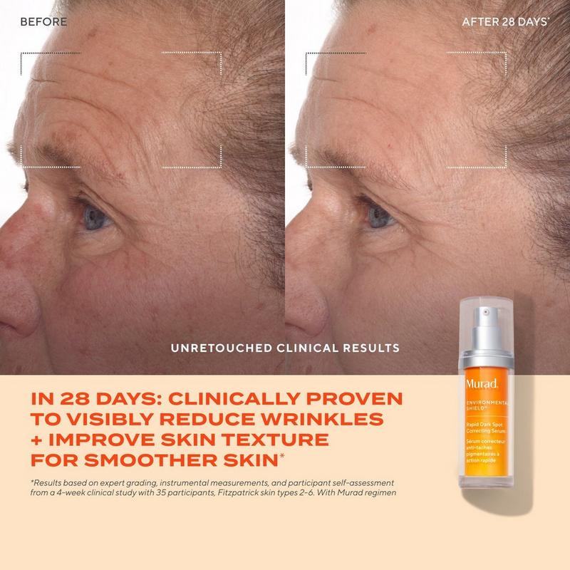 Murad - 0.3 oz Rapid Dark Spot Correcting Serum | Ulta Beauty