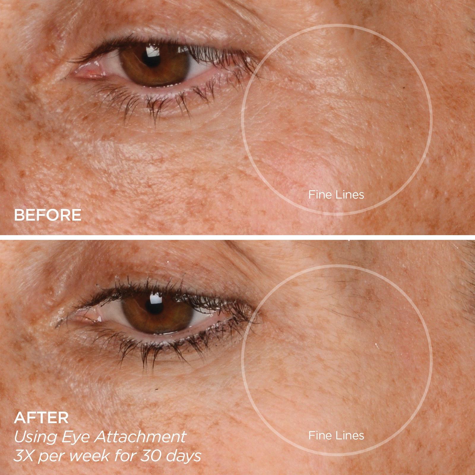 Eye Want It All Face + Eye Rejuvenation Set